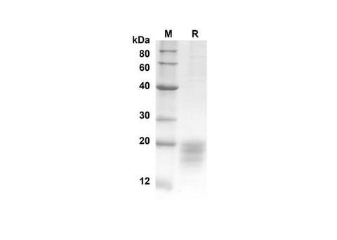 SDS-PAGE analysis of Human IL5 proteins, 2 μg/lane of Recombinant Human IL5 proteins was resolved with an SDS-PAGE under reducing conditions, showing bands at 14.6 kDa.