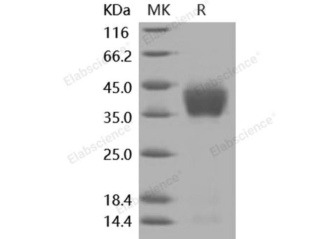 Recombinant Mouse ASGPR1/ASGR1 Protein (His Tag) - ABMIUM