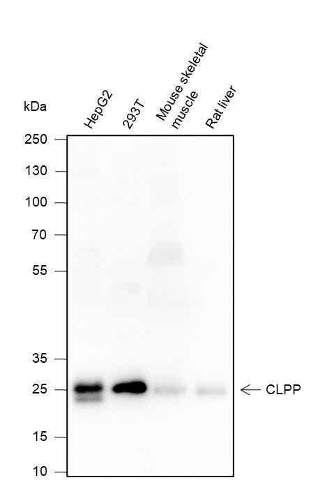 Anti-Human/Rat/Mouse CLPP Antibody [A191]