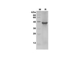 SDS-PAGE analysis of Human GSK3α proteins, 2 μg/lane of Recombinant Human GSK3α proteins was resolved with SDS-PAGE under reducing conditions, showing bands at 39 kDa.