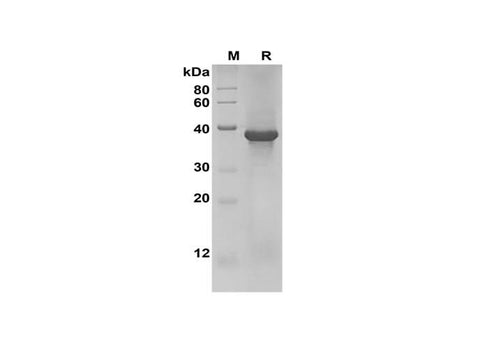 SDS-PAGE analysis of Human GSK3α proteins, 2 μg/lane of Recombinant Human GSK3α proteins was resolved with SDS-PAGE under reducing conditions, showing bands at 39 kDa.