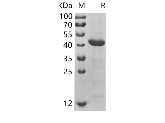 SDS-PAGE analysis of Human KRT7 proteins, 2 μg/lane of Recombinant Human KRT7 proteins was resolved with SDS-PAGE under reducing conditions, showing bands at 44.3 kDa.