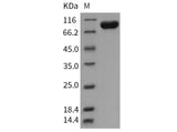 Recombinant Human Tie1 Protein (His Tag) - ABMIUM