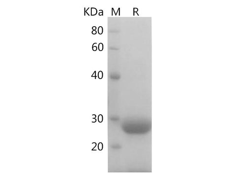 SDS-PAGE analysis of Mouse S100B proteins, 2 μg/lane of Recombinant Mouse S100B proteins was resolved with SDS-PAGE under reducing conditions, showing bands at 12 kDa.