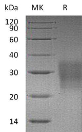 Recombinant Mouse FAS/TNFRSF6 Protein (His Tag) - ABMIUM