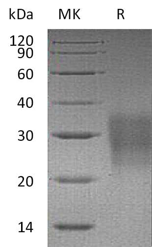 Recombinant Mouse FAS/TNFRSF6 Protein (His Tag) - ABMIUM