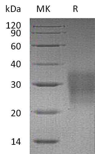 Recombinant Mouse FAS/TNFRSF6 Protein (His Tag) - ABMIUM