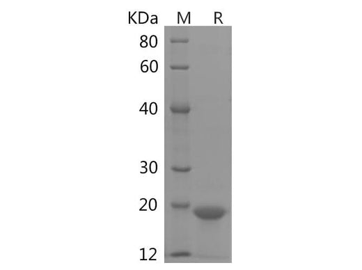SDS-PAGE analysis of Human Synuclein-α（SNCA） proteins, 2 μg/lane of Recombinant Human Synuclein-α（SNCA） proteins was resolved with SDS-PAGE under reducing conditions, showing bands at 19 kDa.