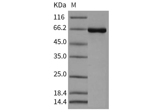 Recombinant Mouse CSNK2A1/CK2A1 Protein (His & GST Tag) - ABMIUM