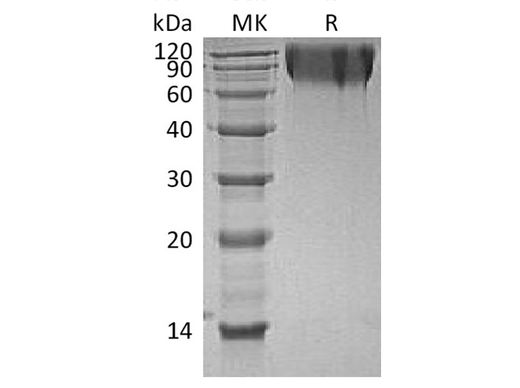 Recombinant Human CEACAM1/CD66a Protein (His Tag) - ABMIUM