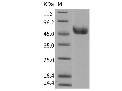 Recombinant Mouse REN1/Renin-1 Protein (His Tag) - ABMIUM