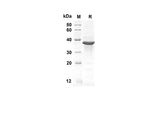 SDS-PAGE analysis of Human GLI1 proteins, 2 μg/lane of Recombinant Human GLI1 proteins was resolved with an SDS-PAGE under reducing conditions, showing bands at 40.7 kDa.