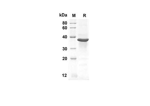 SDS-PAGE analysis of Human GLI1 proteins, 2 μg/lane of Recombinant Human GLI1 proteins was resolved with an SDS-PAGE under reducing conditions, showing bands at 40.7 kDa.