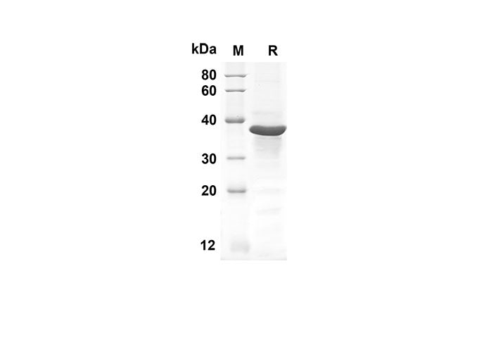 SDS-PAGE analysis of Human GLI1 proteins, 2 μg/lane of Recombinant Human GLI1 proteins was resolved with an SDS-PAGE under reducing conditions, showing bands at 40.7 kDa.