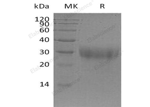 Recombinant Mouse PGF/PIGF Protein (His Tag) - ABMIUM