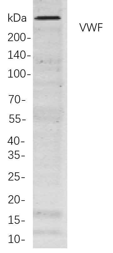 Anti-Human/Mouse/Rat VWF Antibody [B816] - ABMIUM