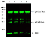 Anti-Human B2M Antibody [A1128] - ABMIUM