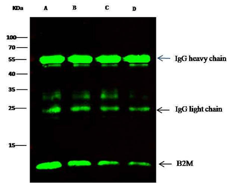Anti-Human B2M Antibody [A1128] - ABMIUM