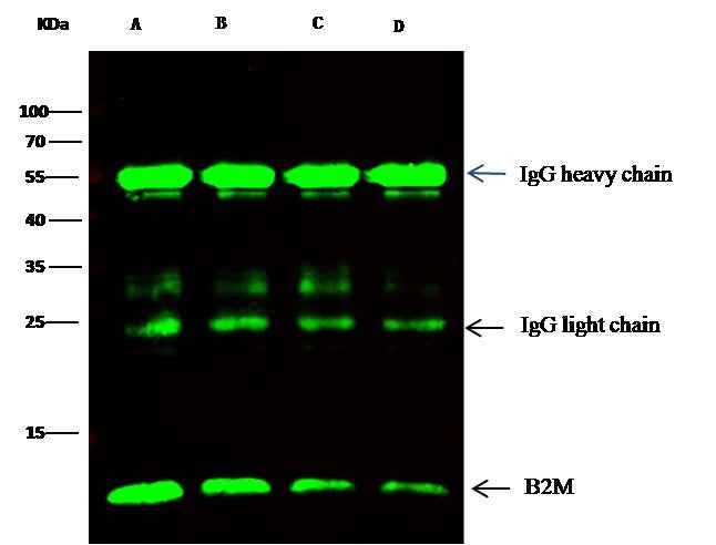 Anti-Human B2M Antibody [A1128] - ABMIUM