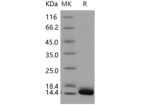 Recombinant Human CALML3 Protein (His Tag) - ABMIUM