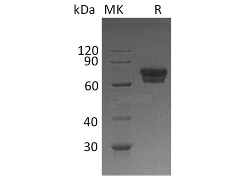 Recombinant Human IL2Ra/CD25 Protein (Fc Tag) - ABMIUM