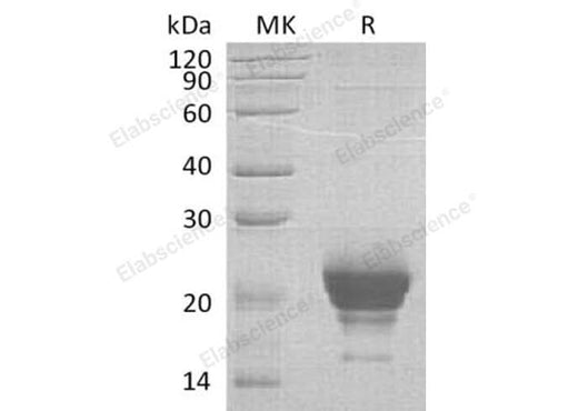 Recombinant Human Ribonuclease K6/RNASE6 Protein (His Tag) - ABMIUM