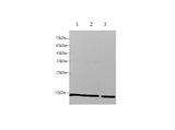 Anti-Human B2M Antibody - ABMIUM
