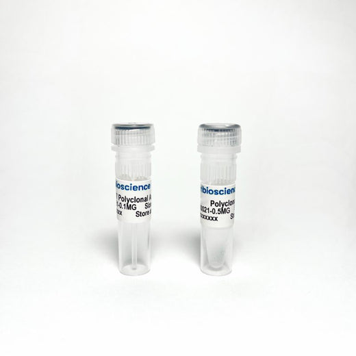 Phospho-Tau Thr217 (p-tau217) Polyclonal Antibody for ELISA, Western Blot and IHC