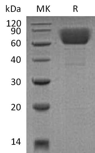 Recombinant Mouse CD39/ENTPD1 Protein (His Tag) - ABMIUM