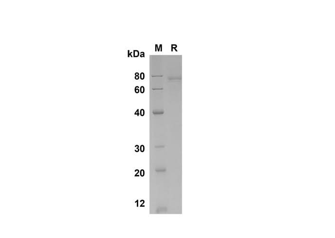 SDS-PAGE analysis of Human GASP-1/WFIKKNRP proteins , 2 μg/lane of Recombinant Human GASP-1/WFIKKNRP proteins was resolved with SDS-PAGE under reducing conditions , showing bands at 80 kDa.