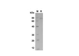 SDS-PAGE analysis of Human GASP-1/WFIKKNRP proteins , 2 μg/lane of Recombinant Human GASP-1/WFIKKNRP proteins was resolved with SDS-PAGE under reducing conditions , showing bands at 80 kDa.