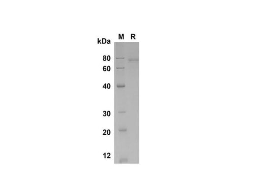 SDS-PAGE analysis of Human GASP-1/WFIKKNRP proteins , 2 μg/lane of Recombinant Human GASP-1/WFIKKNRP proteins was resolved with SDS-PAGE under reducing conditions , showing bands at 80 kDa.