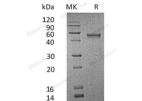 Recombinant Human Lymphotactin/XCL1 Protein (Fc & His Tag) - ABMIUM
