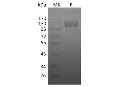 Recombinant Human CSF1R/CD115 Protein (Fc Tag) - ABMIUM