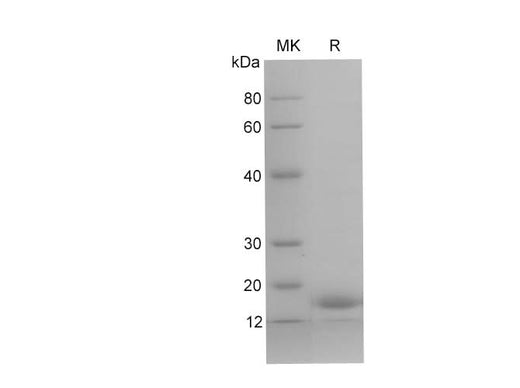 SDS-PAGE analysis of Human TNNC1 proteins, 2 μg/lane of Recombinant Human TNNC1 proteins was resolved with SDS-PAGE under reducing conditions, showing bands at 17 kDa.