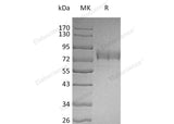 Recombinant Human SIGLEC3/CD33 Protein (Fc & His Tag) - ABMIUM