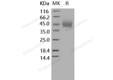 Recombinant Human CD89/FCAR Protein (His Tag) - ABMIUM