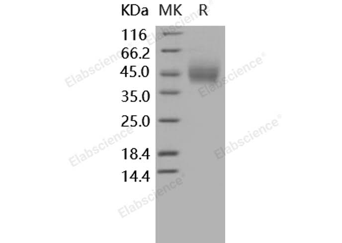 Recombinant Human CD89/FCAR Protein (His Tag) - ABMIUM