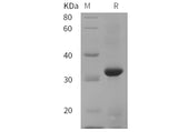 SDS-PAGE analysis of Cynomolgus macaques CD38/ADPRC1 proteins, 2 μg/lane of Recombinant Cynomolgus macaques CD38/ADPRC1 proteins was resolved with SDS-PAGE under reducing conditions, showing bands at 32 kDa.