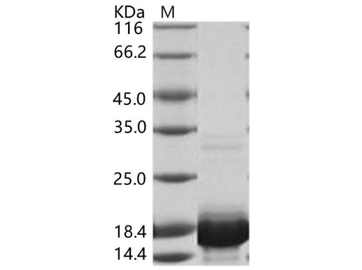 Recombinant DENV-2 (Strain New Guinea C) Capsid protein / DENV-C Protein (His Tag) - ABMIUM