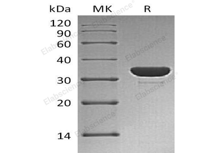 Recombinant Human PTPN6/SH-PTP1 Protein (His Tag) - ABMIUM