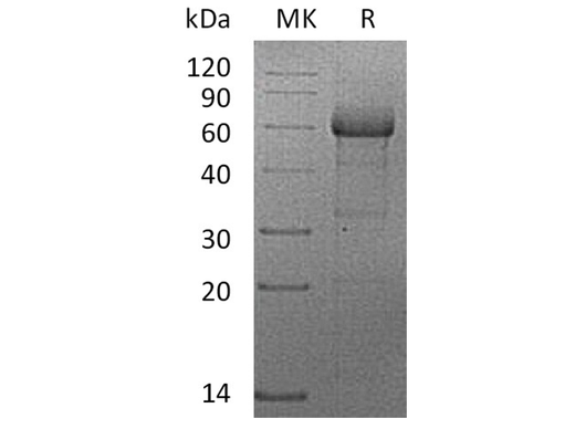 Recombinant Human TNFRSF1B/CD120b Protein (mFc Tag) - ABMIUM