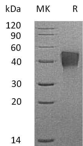 Recombinant Mouse TROP2/TACSTD2 Protein (His Tag) - ABMIUM