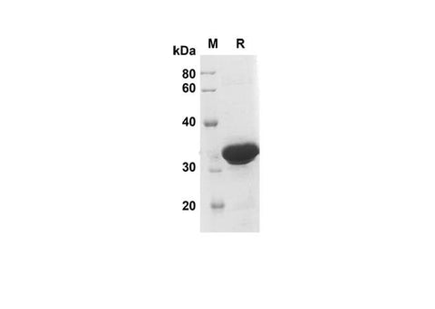 SDS-PAGE analysis of Human MPO proteins , 2 μg/lane of Recombinant Human MPO proteins was resolved with SDS-PAGE under reducing conditions , showing bands at 35 kDa.