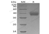 Recombinant Human CD89/FCAR Protein (His Tag) - ABMIUM