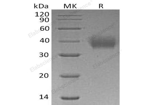 Recombinant Human CD89/FCAR Protein (His Tag) - ABMIUM