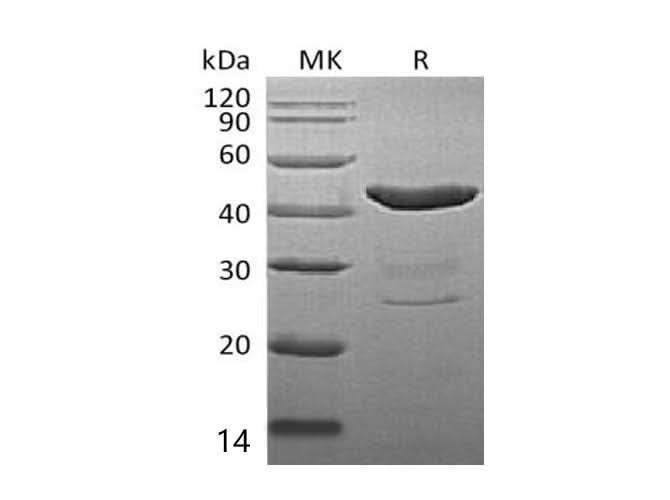 Recombinant Mouse IDO1/IDO Protein (His Tag) - ABMIUM