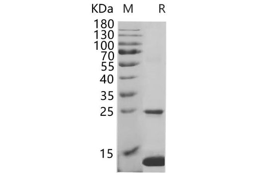 SDS-PAGE analysis of Human S100A8 proteins, 2 μg/lane of Recombinant Human S100A8 proteins was resolved with SDS-PAGE under reducing conditions, showing bands at 13.1 kDa.