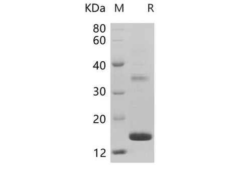 SDS-PAGE analysis of Rat REG4 proteins, 2 μg/lane of Recombinant Rat REG4 proteins was resolved with SDS-PAGE under reducing conditions, showing bands at 18.2 kDa.