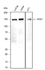 Anti-Human/Mouse PKN1 Antibody [A335]